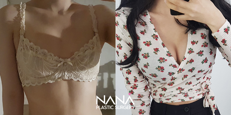 가슴이미지