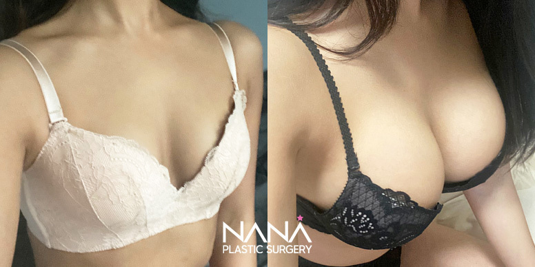 가슴이미지