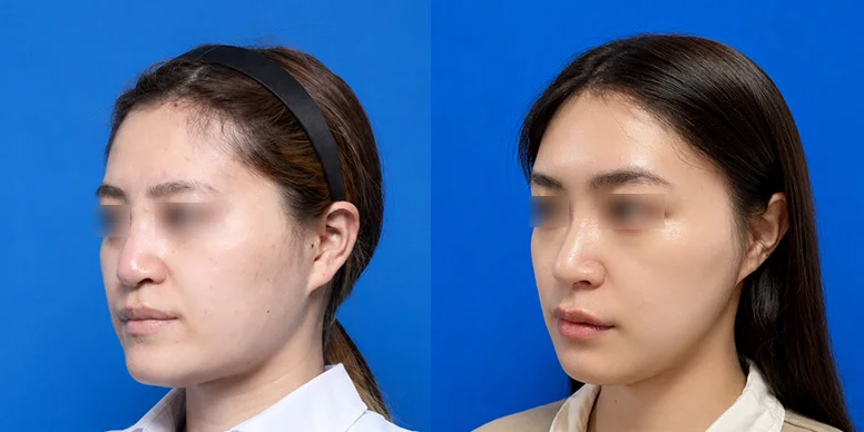 Before & After Before & After