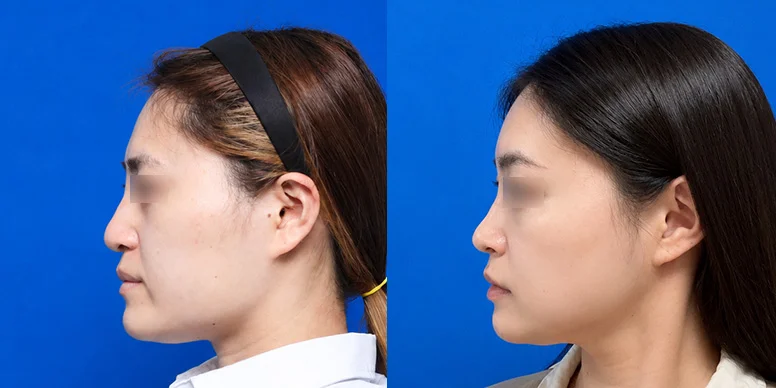 Before & After Before & After