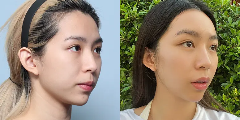 Before & After Before & After