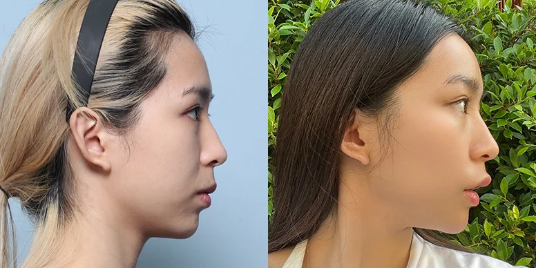 Before & After Before & After