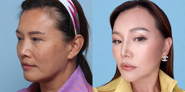 Before & After Before & After
