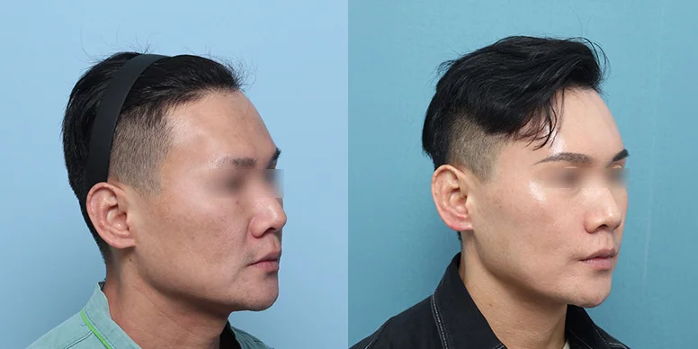 Before & After Before & After