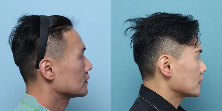 Before & After Before & After