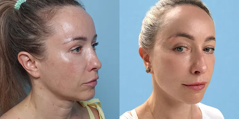 Before & After Before & After