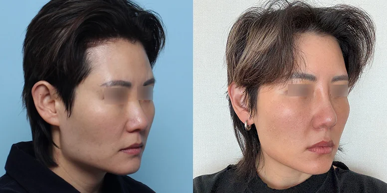 Before & After Before & After