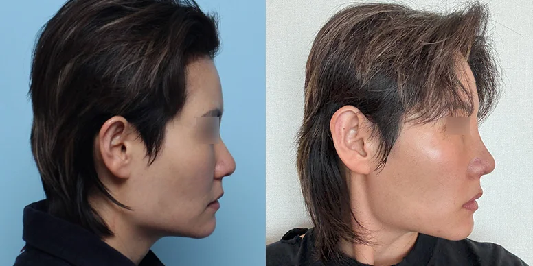 Before & After Before & After