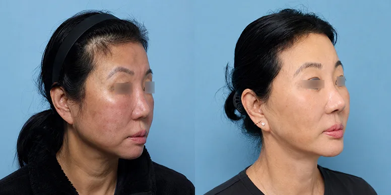Before & After Before & After