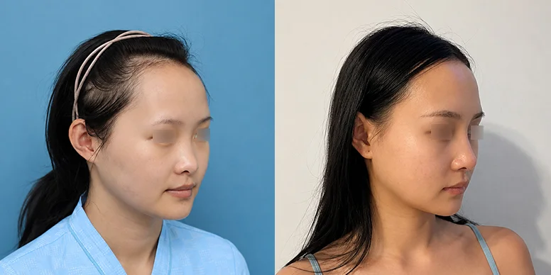 Before & After Before & After