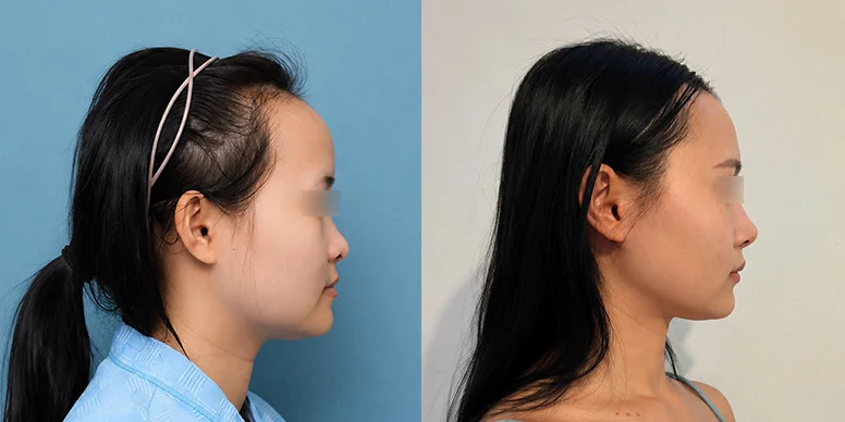 Before & After Before & After