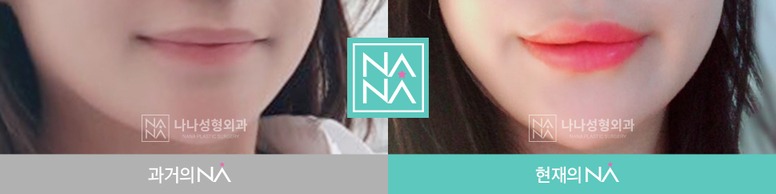 Other Before & After — Before & After