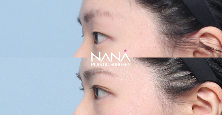 Sebelum & Sesudah Sebelum & Sesudah