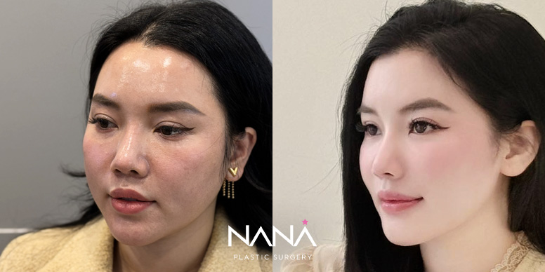Before & After Before & After