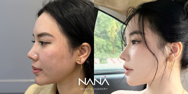 Before & After Before & After