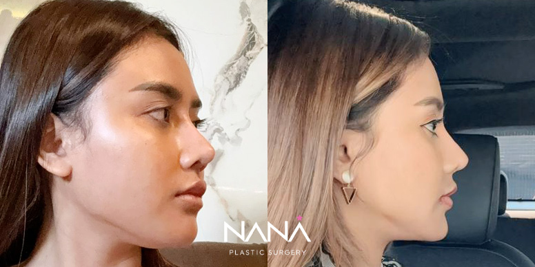 Before & After Before & After