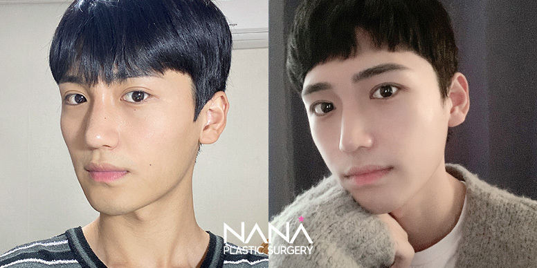 Before & After Before & After