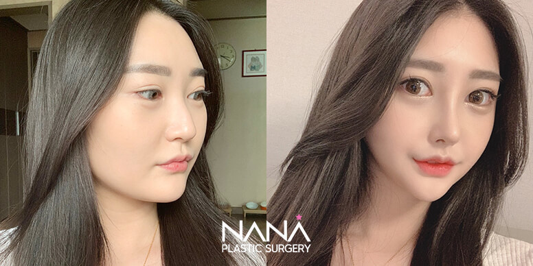 Before & After Before & After