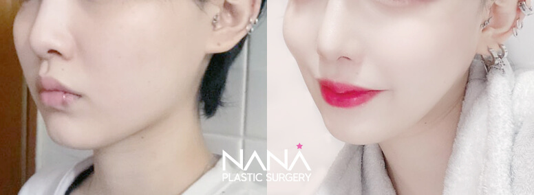 Before & After Before & After