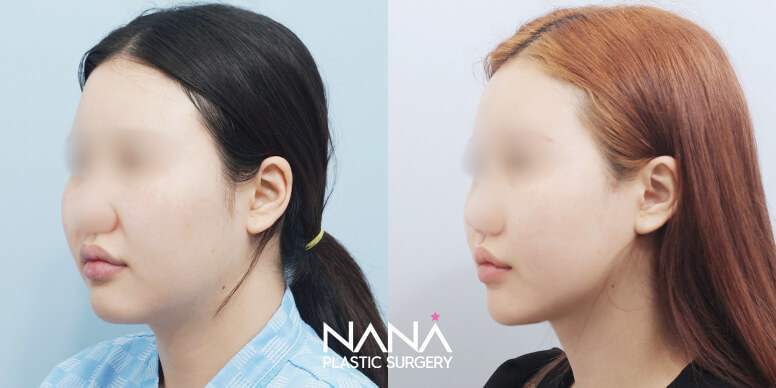 Before & After Before & After