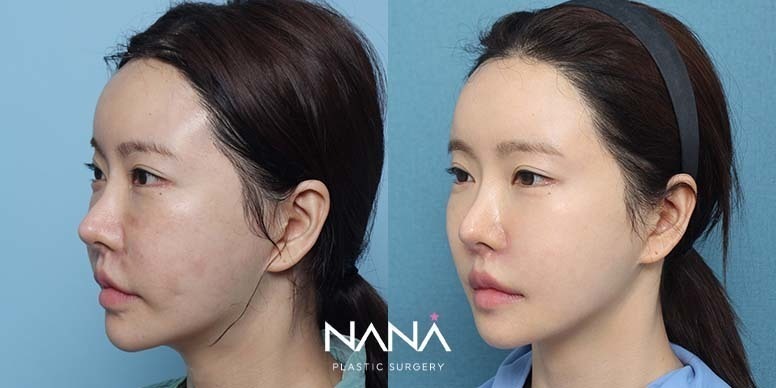 Before & After Before & After