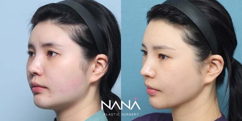 Before & After Before & After