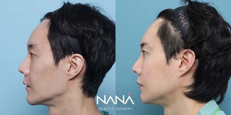 Before & After Before & After