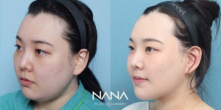 Before & After Before & After