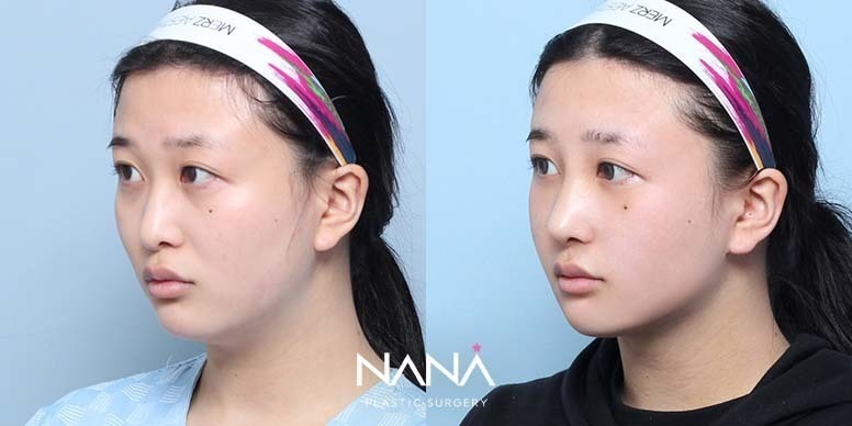 Before & After Before & After