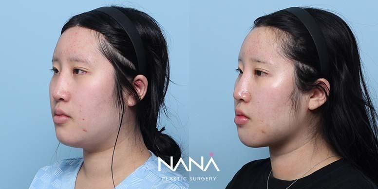 Before & After Before & After