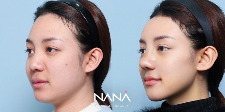 Before & After Before & After
