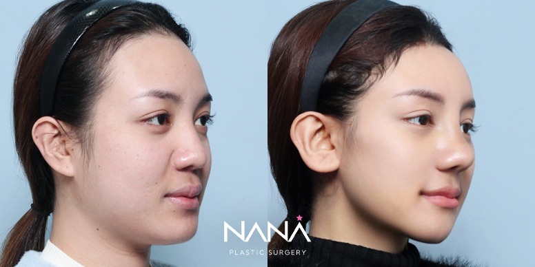 Before & After Before & After