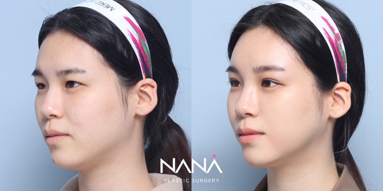 Before & After Before & After