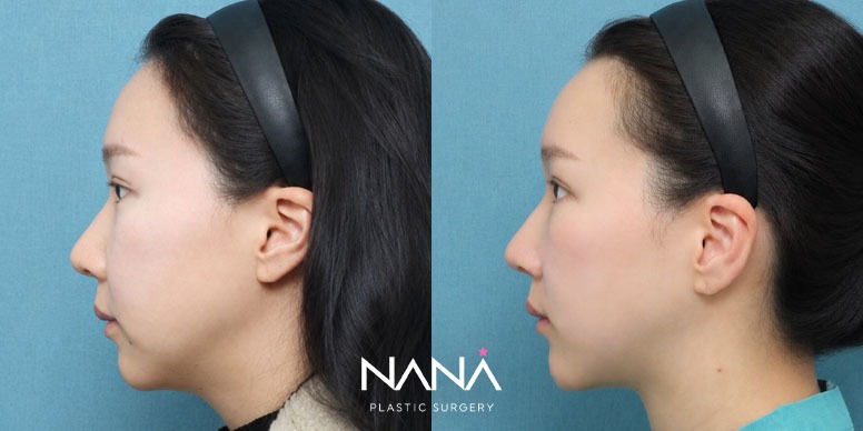 Before & After Before & After