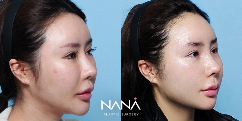 Before & After Before & After