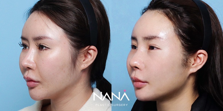 Before & After Before & After