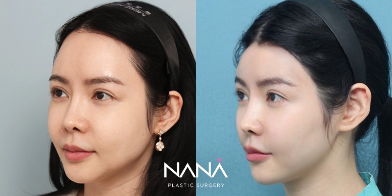 Before & After Before & After