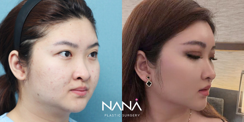 Before & After Before & After