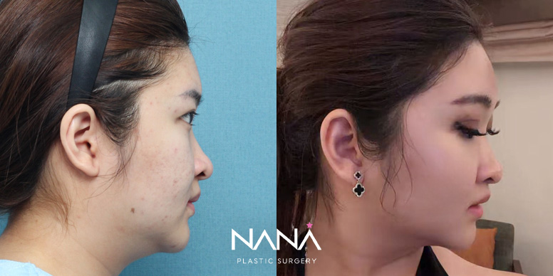 Before & After Before & After