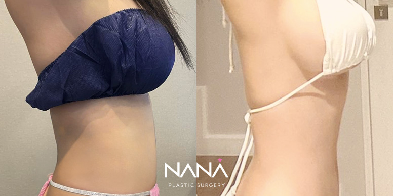 Before & After Before & After