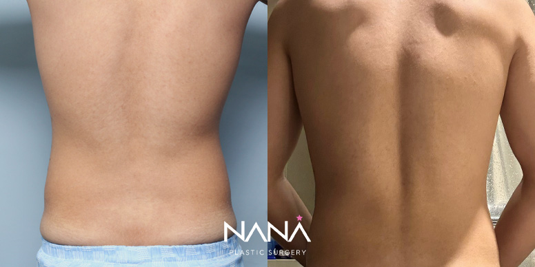 Before & After Before & After