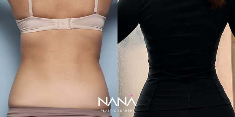 Before & After Before & After