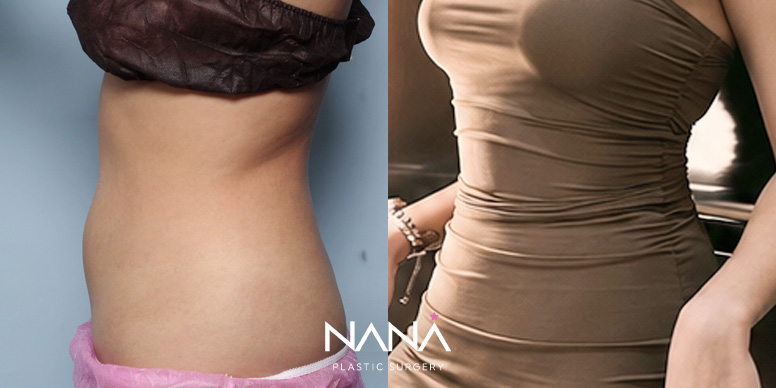 Before & After Before & After