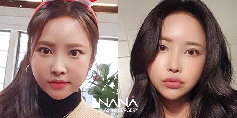 Before & After Before & After