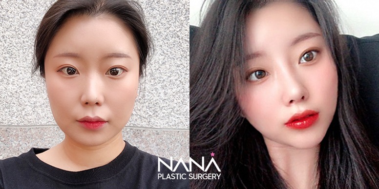 Before & After Before & After