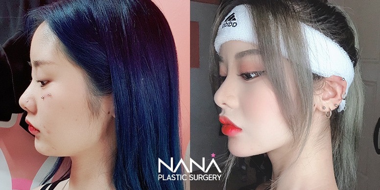Before & After Before & After