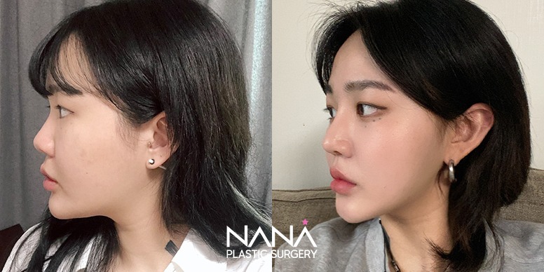 Before & After Before & After