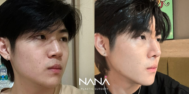 Before & After Before & After