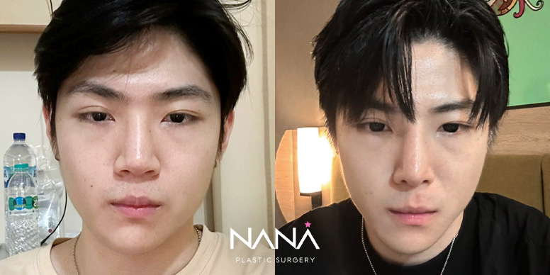 Men Before & After — Before & After