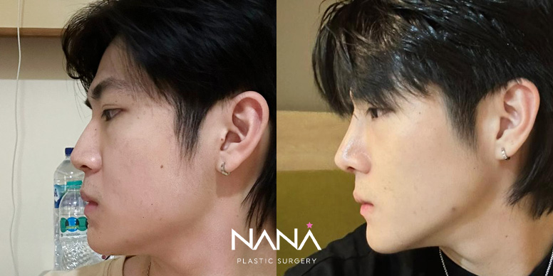 Before & After Before & After